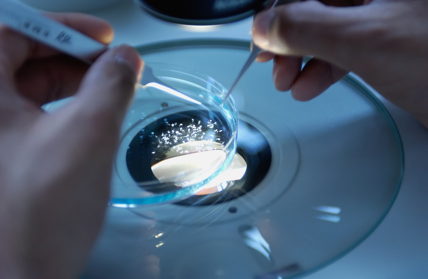 Bone cells being examined under microscope